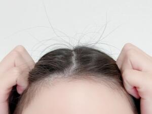 アホ毛を抑える方法やアイテム紹介!パヤパヤの原因と予防策も紹介!