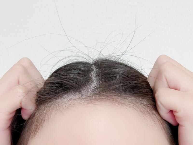アホ毛を抑える方法やアイテム紹介!パヤパヤの原因と予防策も紹介!